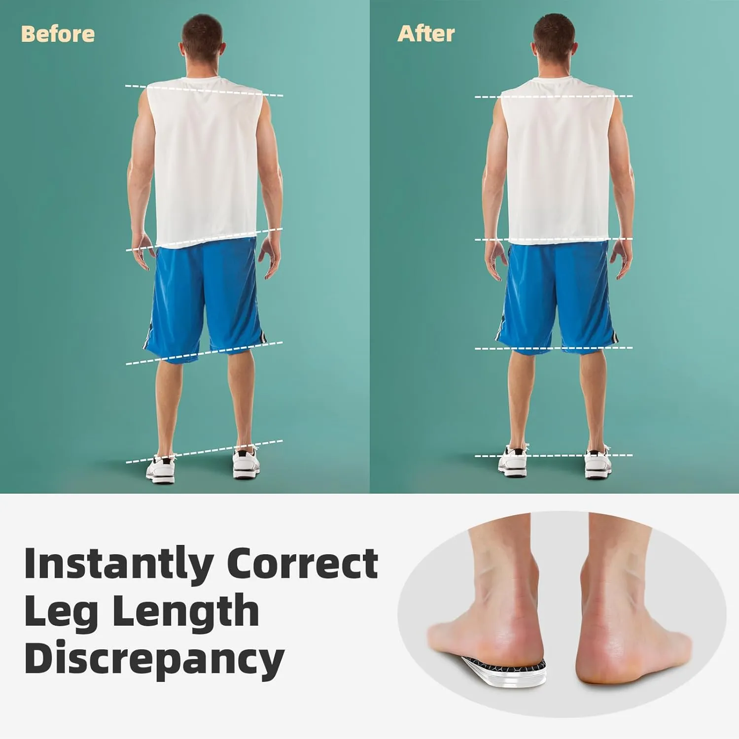 Heel Lifts for Uneven Legs, 4 Layers Adjustable Orthopedic Shoe Lifts, Leg Length Discrepancy, 1/8" 1/4" 3/8" 1/2" (Pack of 1, Size Large)